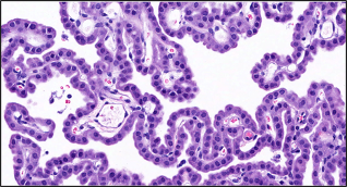 Osteopathy and the choroid plexus
