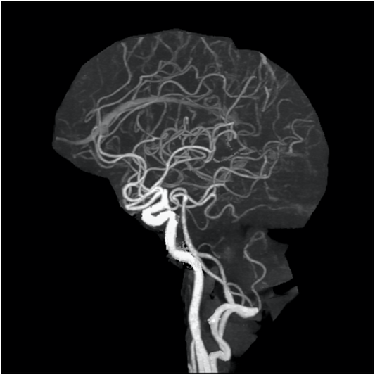 Osteopathy: cerebral blood flow:Understanding The Autonomic Nervous System And Its Scientific Osteopathic Approach