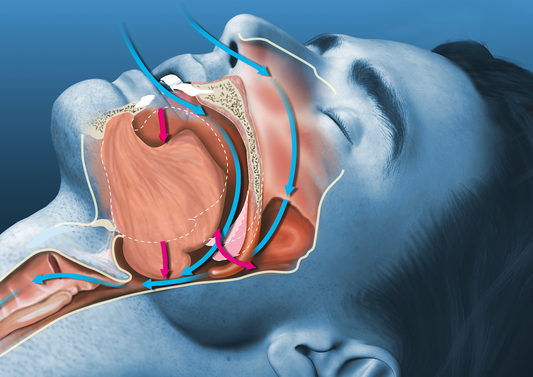 Obesity and sleep apnea: a vicious cycle Osteopathybooks
