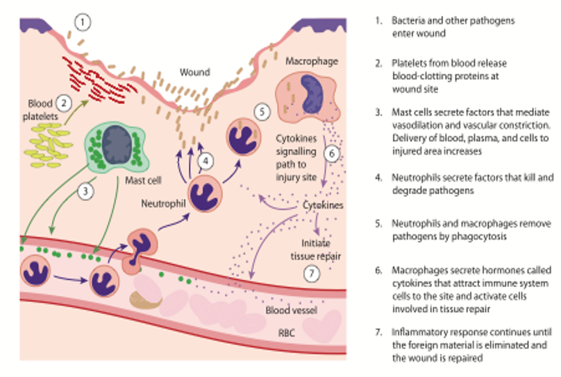 Osteopathy: the inflammatory response