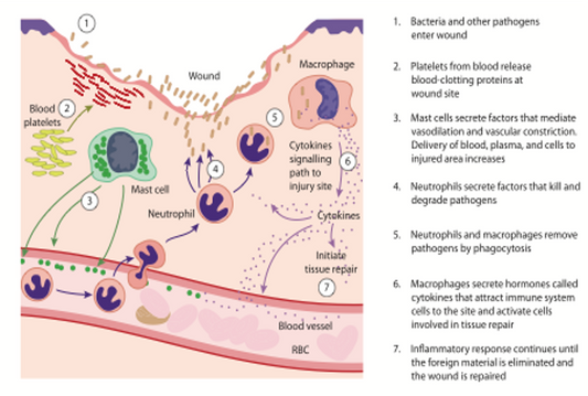 Osteopathy: the inflammatory response
