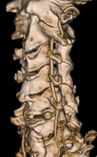Cervical spine