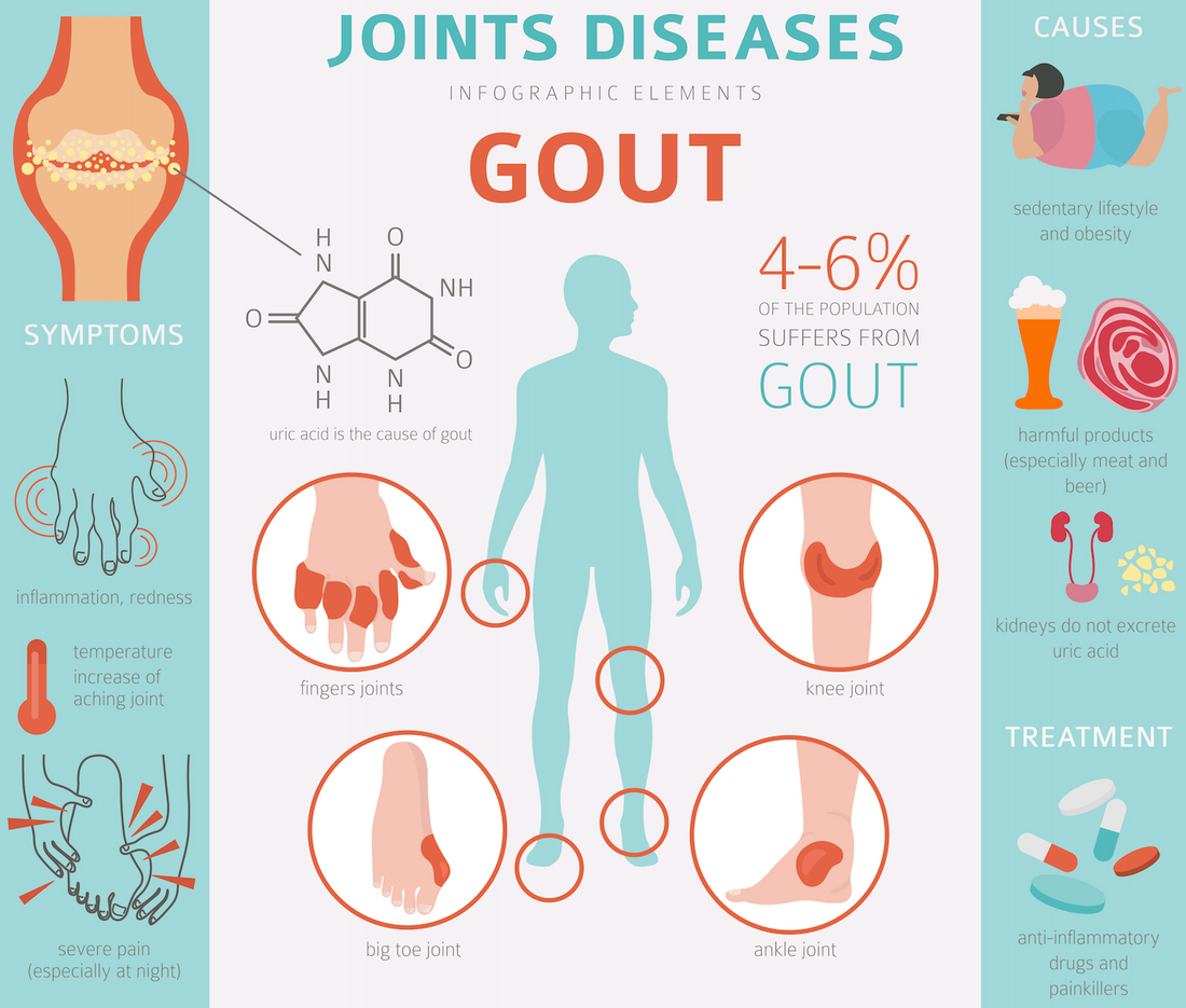 Osteopathy and gout