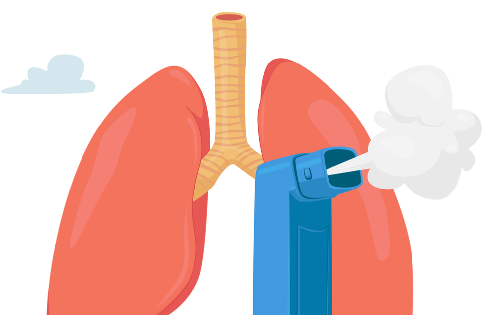 Do we recognize the seriousness of an acute asthma-attack? Osteopathybooks