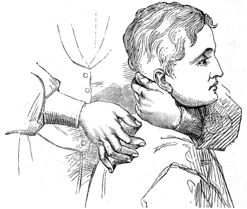 History of spinal manipulation